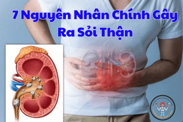7 Nguyên Nhân Chính Gây Ra Sỏi Thận – Cảnh Báo Và Cách Phòng Ngừa Từ Gốc