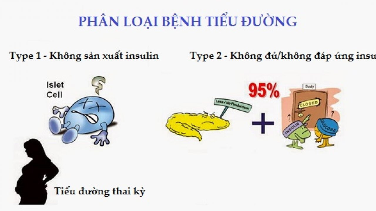 phan-loai-benh-tieu-duong-