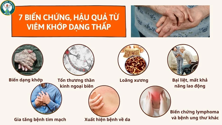 cac-bien-chung-benh-dau-khop