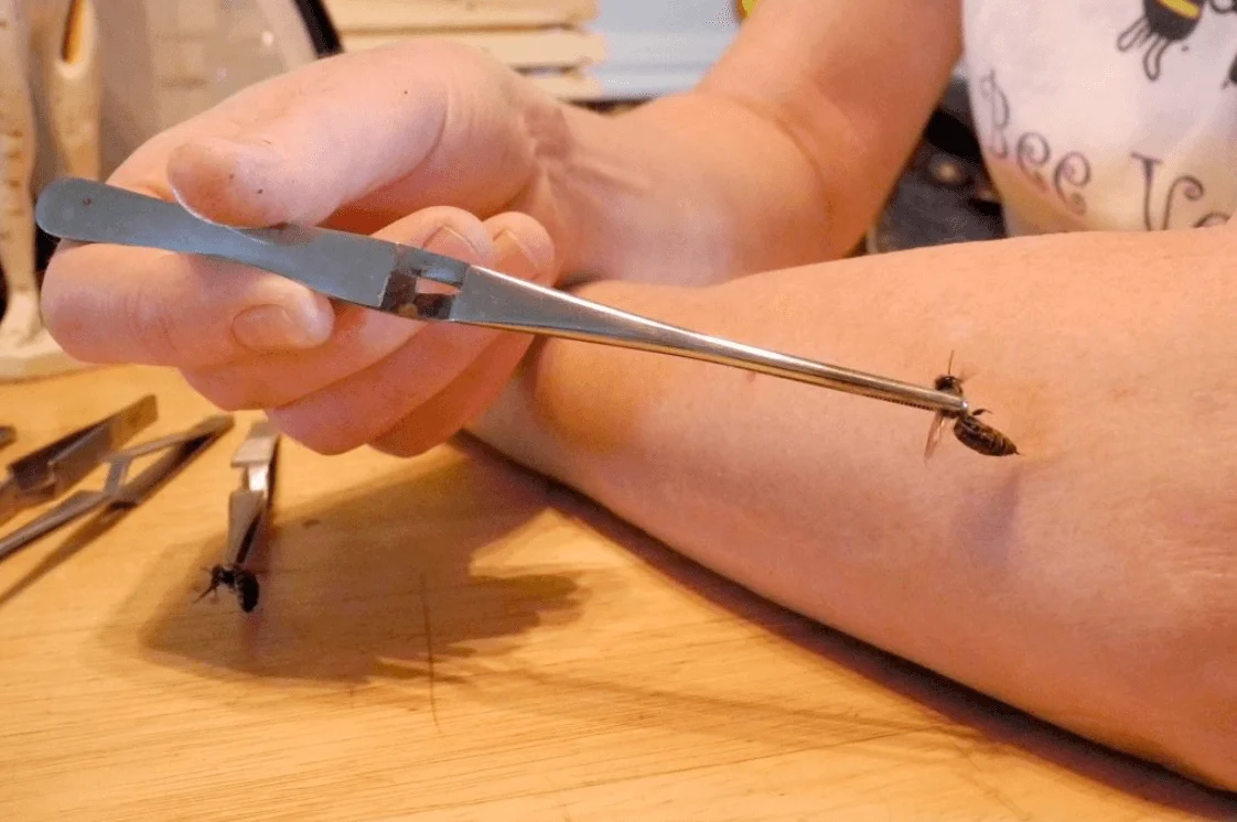 Dầu Nọc Ong Sử Tử Đỏ - Bee Apitherapy Singapore 120 ML 22 noc-ong-dieu-tri-dau-nhuc 2